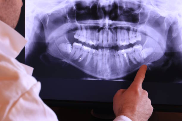 Best Emergency Dental Care for Abscessed Tooth in Lost Hills, CA